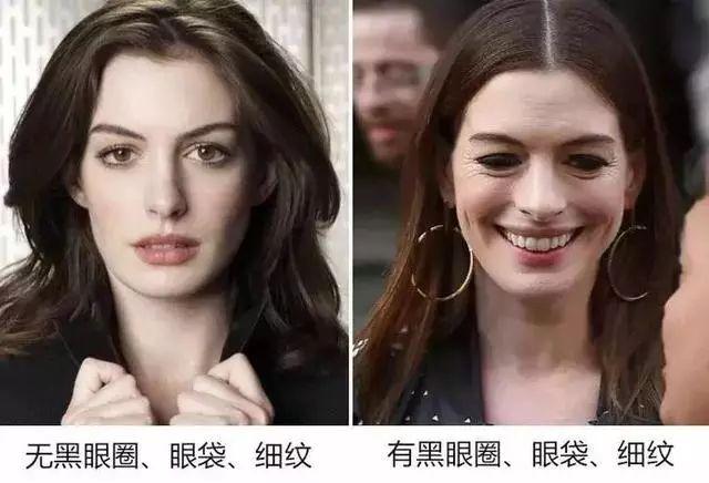 玻尿酸做眼罩方法,玻尿酸冻干眼罩