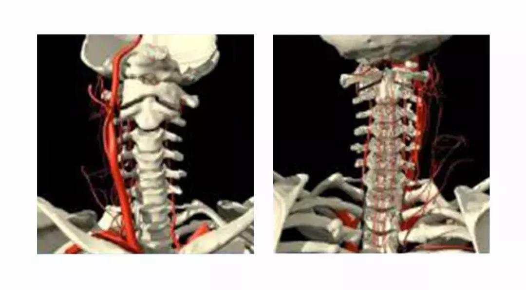 颈椎腰腿痛针刀,针刀颈椎病