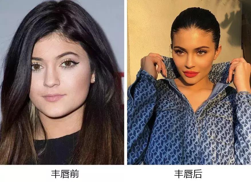 厚嘴唇有多美,厚嘴唇也很好看的女生