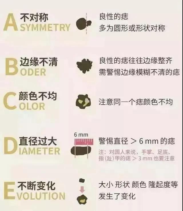 扁平疣和黑色素痣区别,疣与色素痣的区别