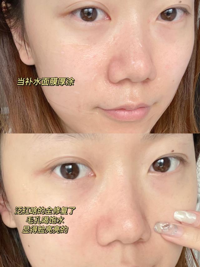 芦荟胶的正确详细用法,芦荟胶正确使用方式