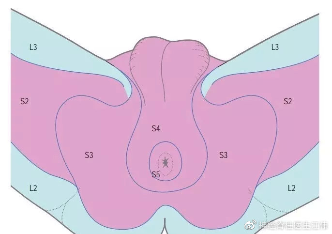 骶管囊肿介入治疗最新进展,骶管囊肿可以鉴定出来吗