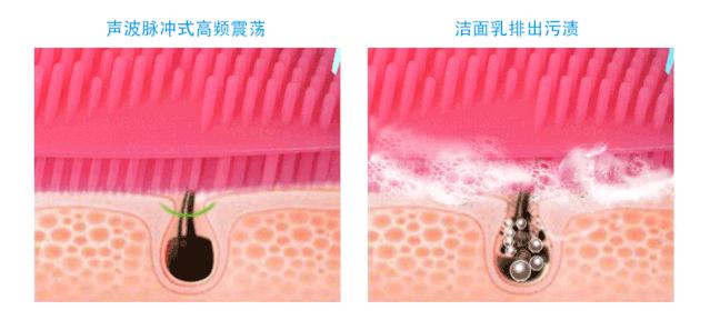 带你揭秘ReFa、Luna背后家用美容仪到底是「坑」还是「宝」？