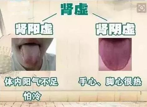 肾虚阴亏症状,肾虚腿部症状
