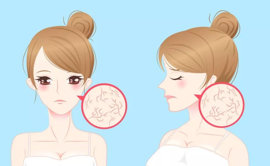 换季时皮肤干燥、瘙痒怎么办？这份护肤指南帮你缓解皮肤尴尬