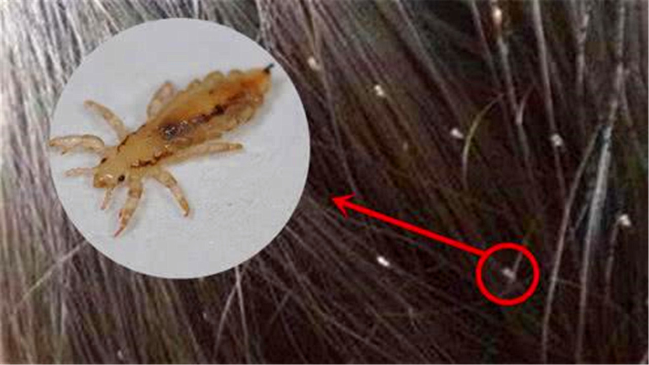 同人类祖先同时进化的人,人类进化了这么久为何还自相残杀