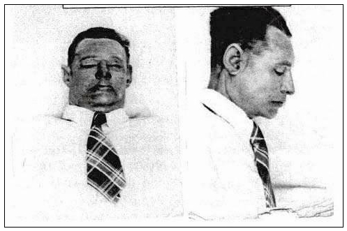 澳大利亚1948年未解悬案,西装男离奇躺在沙滩上,可疑护士被吓晕