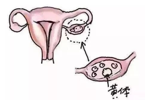 疫情期间妇科疾病,疫情时期要去医院看病