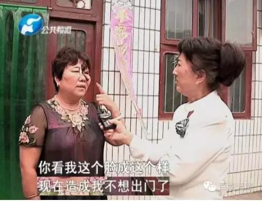 被美容院害烂脸,被美容院害惨了的女人