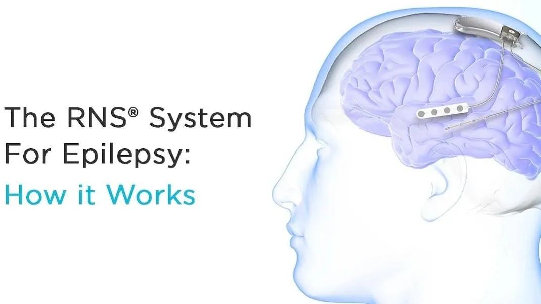 神经调控技术发展前景,神经调控前沿疗法