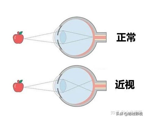一文看懂光学深度解析,深圳近视眼验光配眼镜