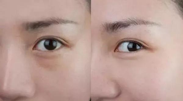 眼霜到底有没有用啊,眼霜里面有什么成分不能用