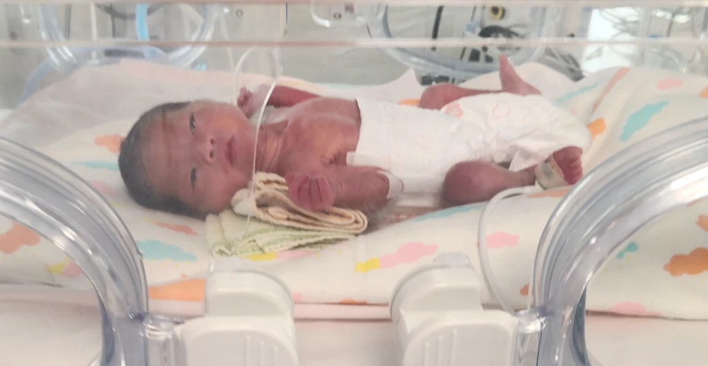 早产儿健康成长科普,早产儿健康成长记录