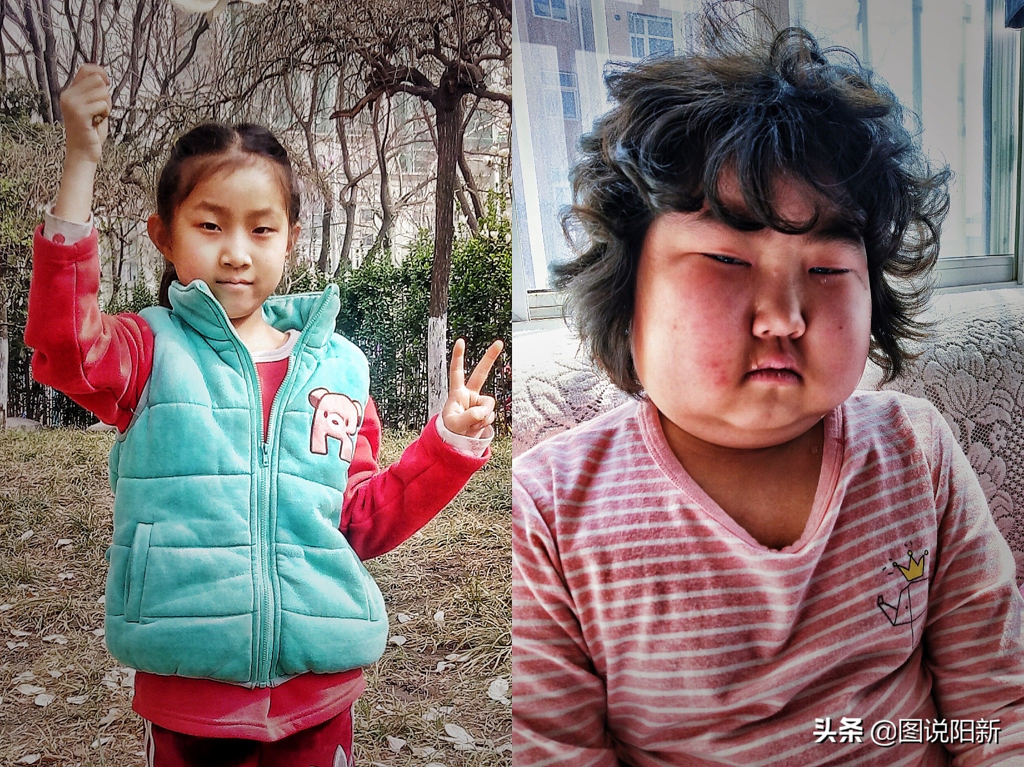 女孩患了200万分之一罕见病,女孩身患罕见怪病