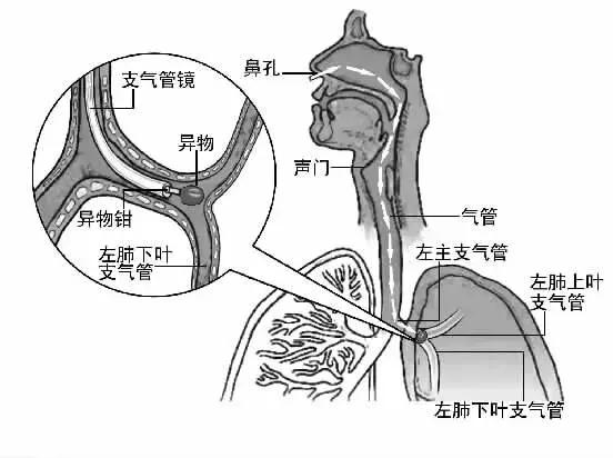 行走的蒲公英猫咪照片,行走的蒲公英猫品种