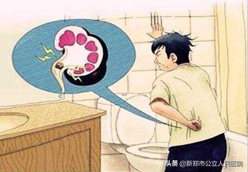 尿结石腰疼说明石头在哪里卡着呢,腰疼得厉害小便血尿是怎么回事