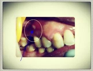 Helen榻跨涓績,helen榻跨