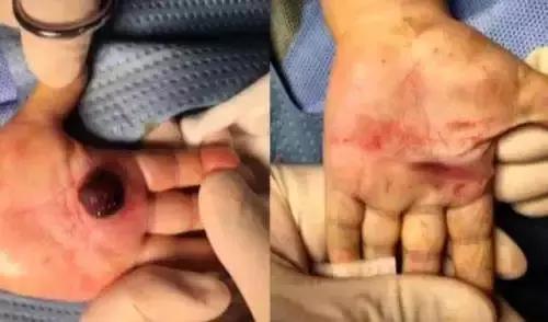 生吞泥鳅清除宿便、给孩子喂活蝌蚪下火...被偏方坑苦了的国人