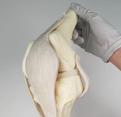 老人膝盖疼平时应怎么样康复锻炼,老年人膝盖后面肌肉疼痛怎么回事