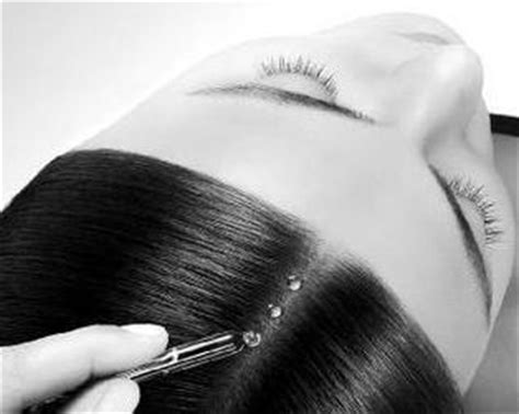 正确消除头皮屑的方法,怎样明确引起头皮屑的病因