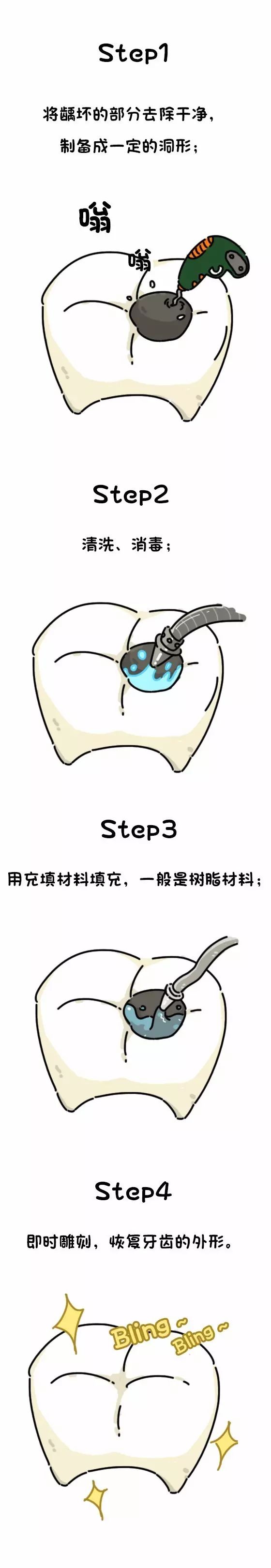 孩子长龋齿蛀牙怎么办,2岁半宝宝龋齿蛀牙严重怎么补救