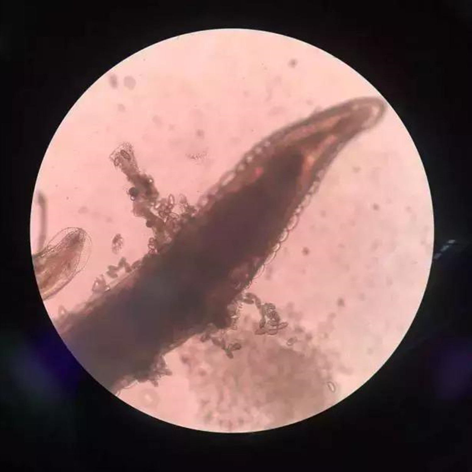 1岁宝宝半夜哭闹抓屁屁,四岁小孩总说屁痒