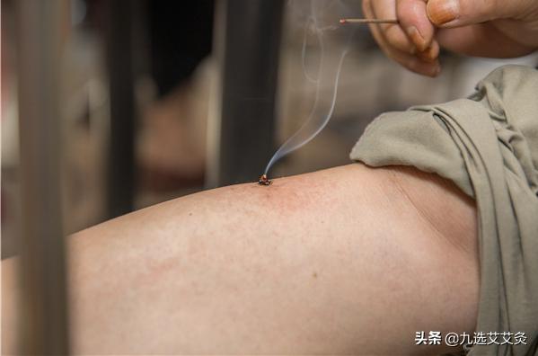 中暑怎么灸,中暑应对