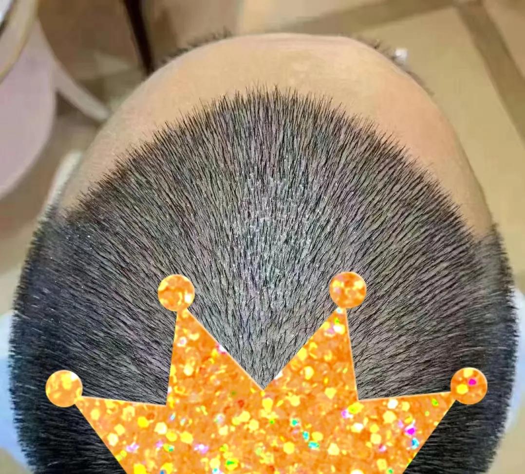 多剃头发会使头发更浓密吗,怎么样可以使自己的头发变浓密