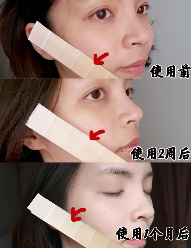 美白针副作用曝光,美白针是违规药品吗