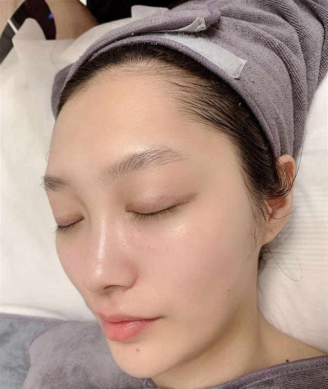 脸上好多闭口粉刺怎么彻底去除,50岁女人脸上起闭口粉刺怎么清除