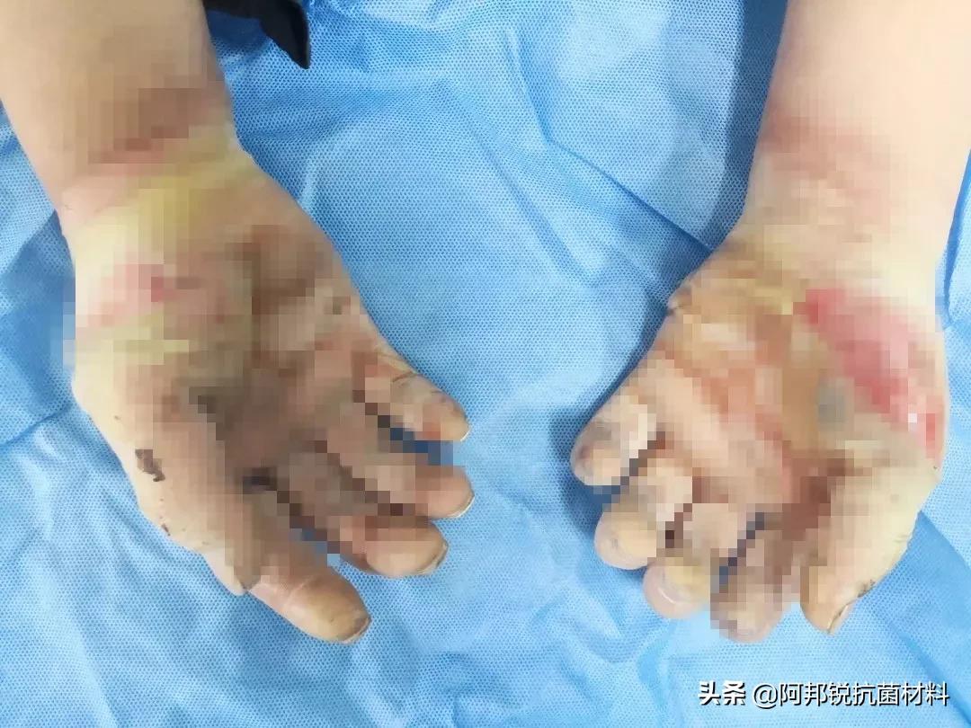 消毒产品可选择哪些,消毒产品一般选什么类目