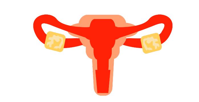 宫颈癌真的那么可怕吗,为啥宫颈癌那么可怕