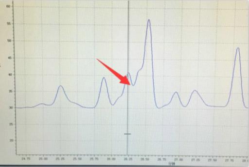 色谱分离中的四种典型情况,常见液相色谱故障排除方法
