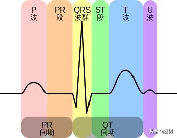 心电图t波改变是冠心病吗,心电图报告t波改变是冠心病吗