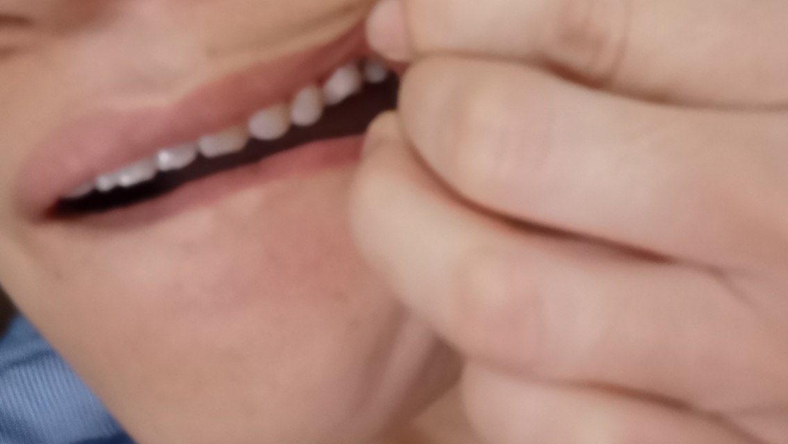 第一次根管治疗牙齿一碰就疼,牙齿做根管治疗要多少钱