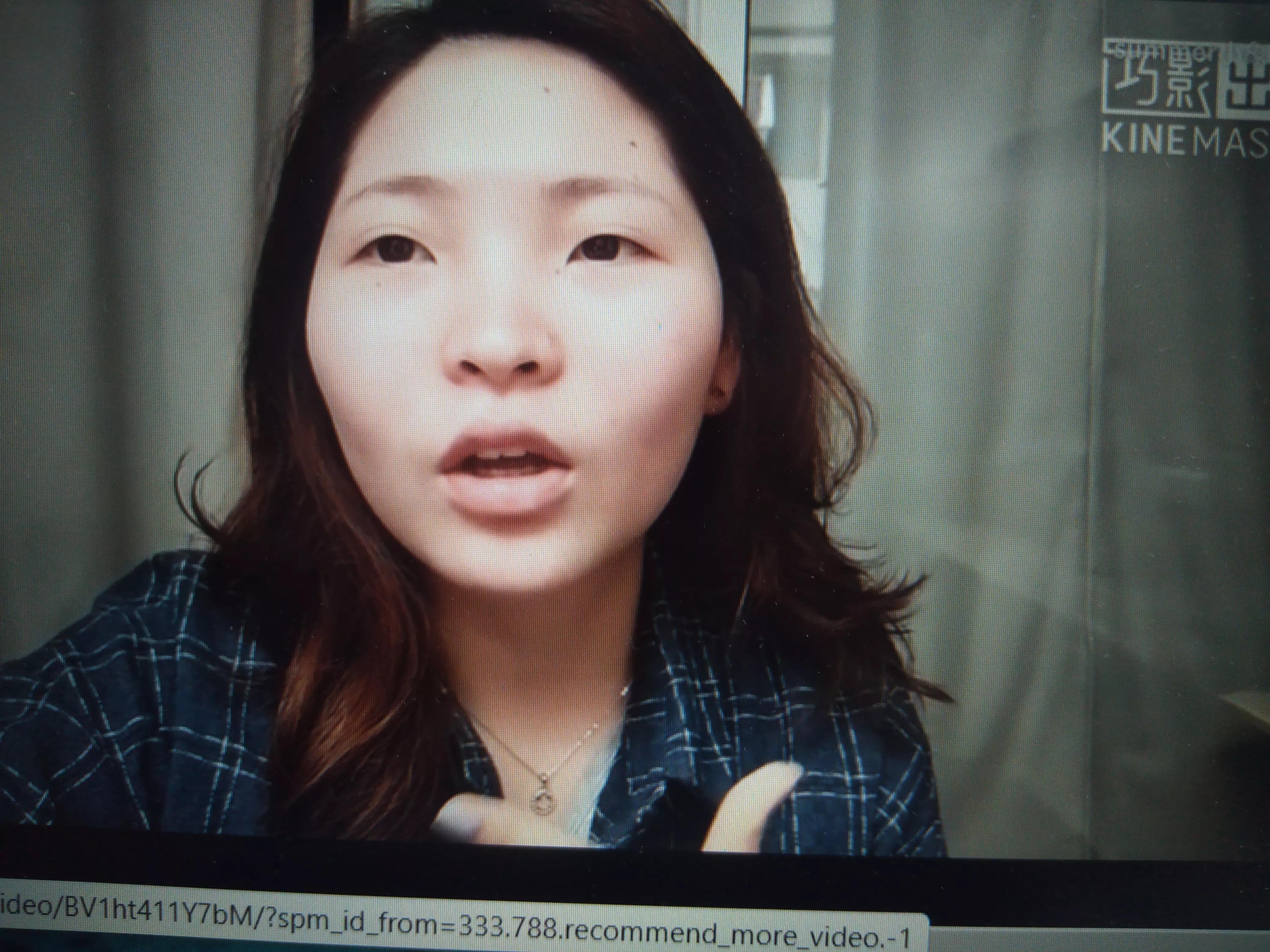 脸上的痣可以点掉吗相学,脸上的痣有毛能不能点掉