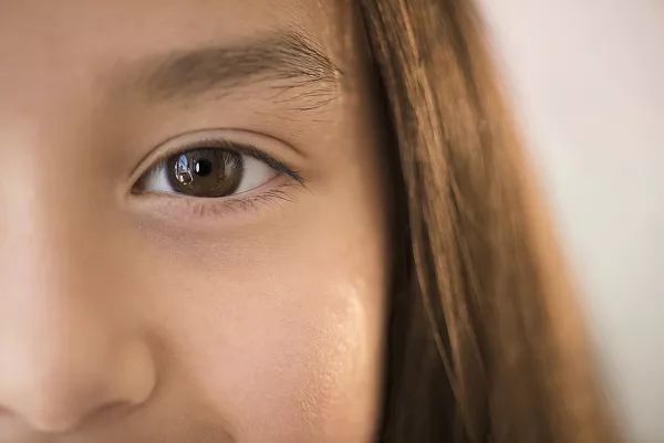 烂脸警告，这些膏求求你别再乱用啦！