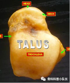 刚崴脚是要冷敷还是热敷,崴脚后24小时内是热敷还是冷敷