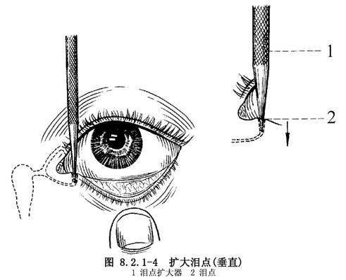 母乳新生儿有眼屎是上火吗,月子里的辟谣是真是假