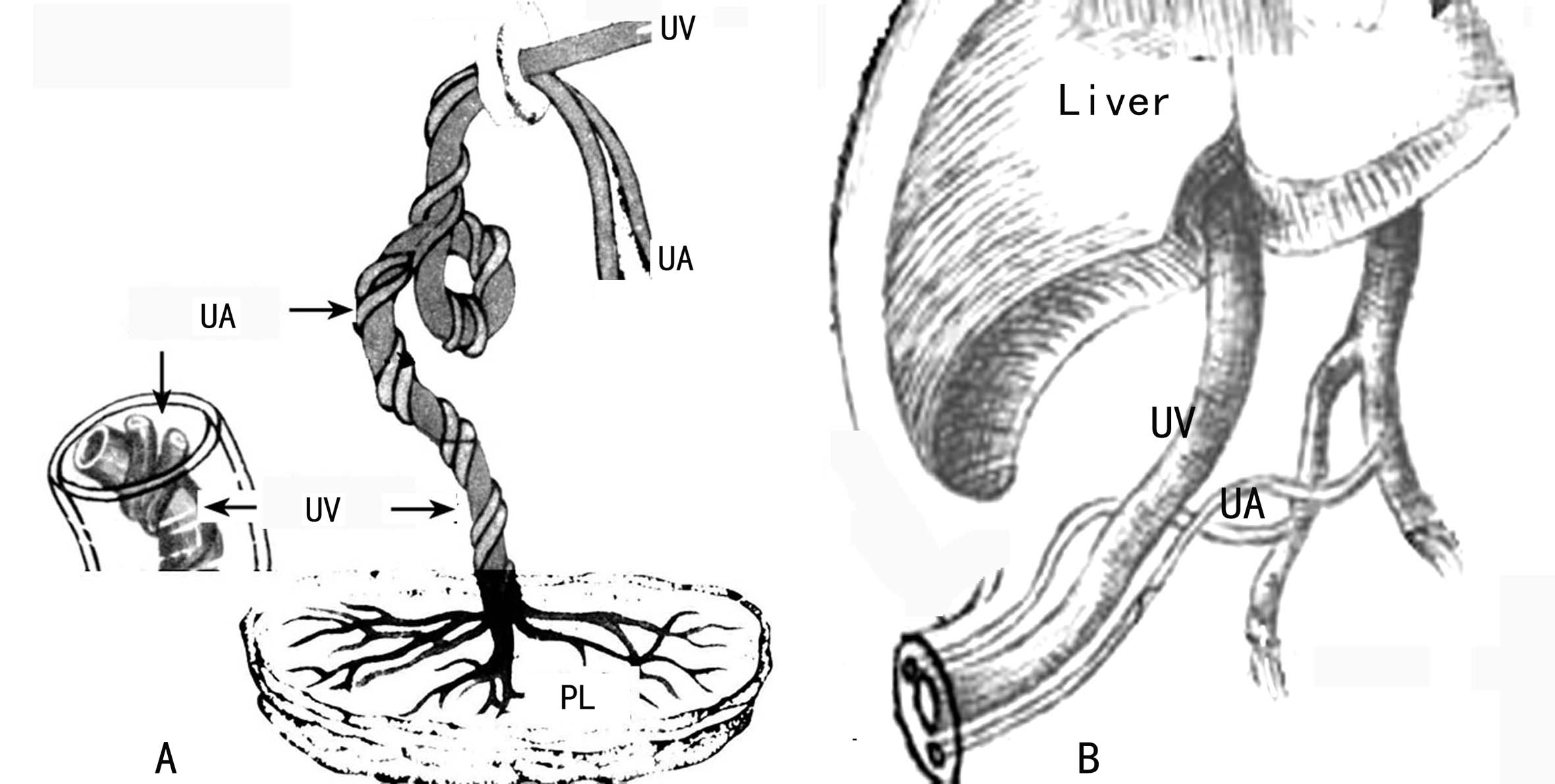一级超声检查能检查出脐带绕颈吗,脐带超声检查图解