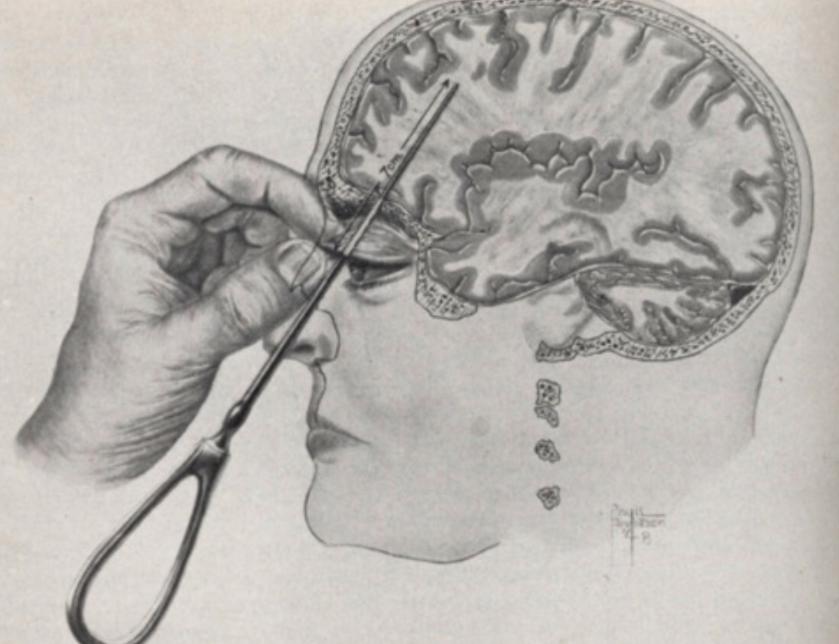 美国精神病院真实视频,美国精神病院的真实生活视频