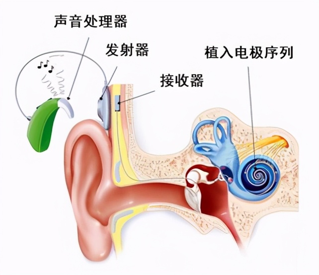 一场手术,一场紧急救治将孩子抢了回来