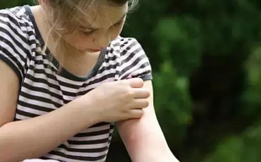 宝宝被蚊子咬了怎么消肿止痒最快,被蚊子咬了怎么止痒消肿用什么药