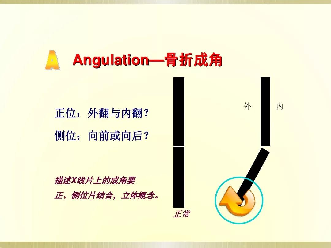 骨科x光片读片技巧,放射科骨科读片教程