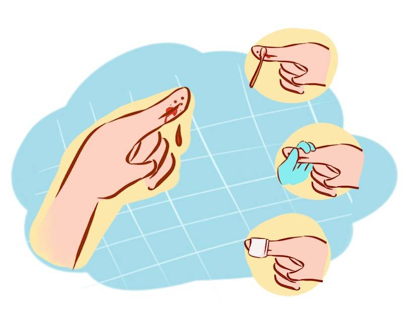 伤口有黄痂怎样处理,伤口上的黄膜