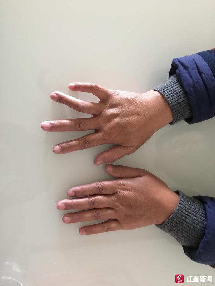 女子车祸身亡赔偿60万,女子车祸1个月后流产索赔6万获2千