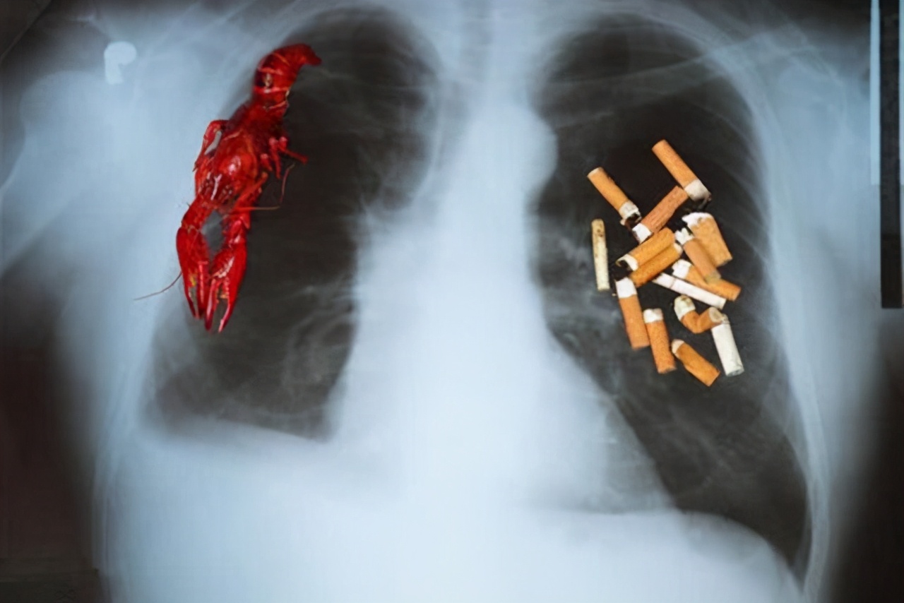 肺癌化疗与靶向治疗哪个好,肺癌靶向药物冲突吗