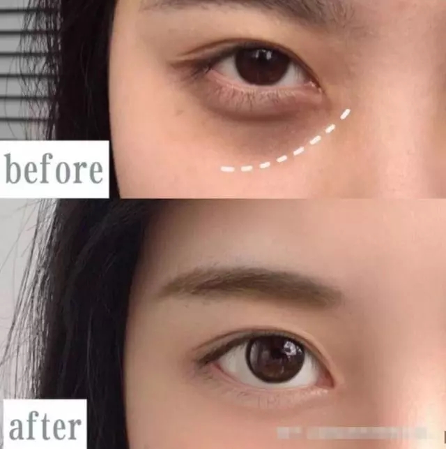 眼霜抗皱去细纹什么平价品牌最好,平价好用适合60岁妈妈用的眼霜