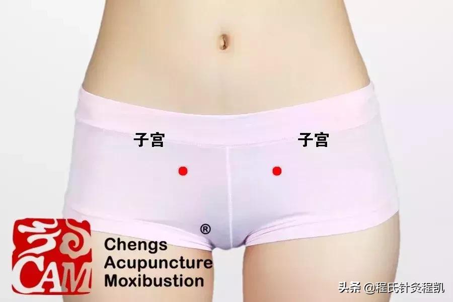 痛经只能默默忍受？中医艾灸调经止痛有奇效