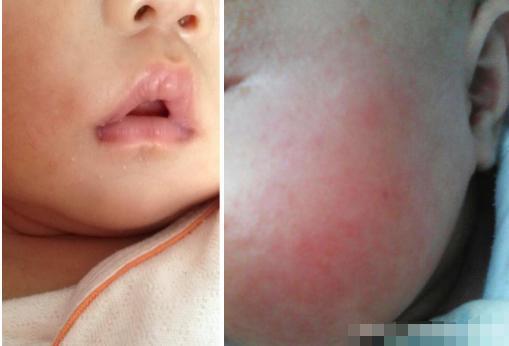 屈臣氏面霜推荐,林志颖面霜推荐